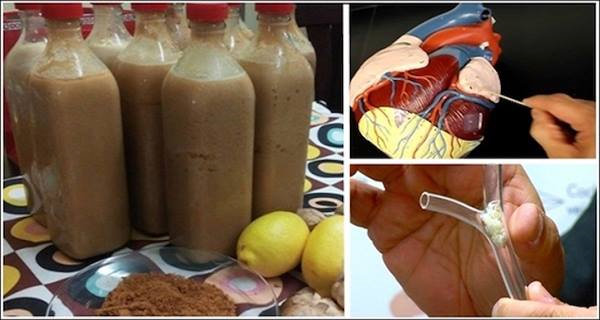 Obat Jamu Ini Efektif Mengatasi Masalah Bagi Anda Yang Mengidap Masalah Kolestrol dan Jantung !