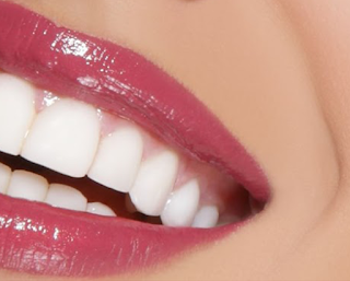 Hollywood Smile Dental Clinic In Dubai
