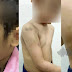 Budak 5 tahun lebam & cedera di kemaluan akibat didera 'Mummy & Daddy'