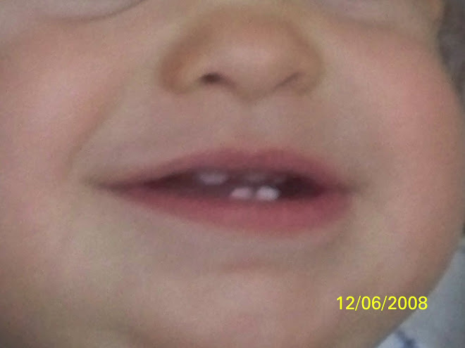 5 teeth! The sixth is on it's way!
