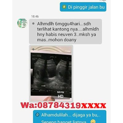 JUAL NEUVEN DI TARAKAN