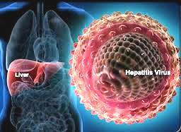 penyakit hepatitis