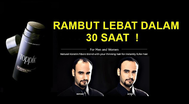 Rambut Lebat Dalam 30 Saat Dengan TOPPIK!