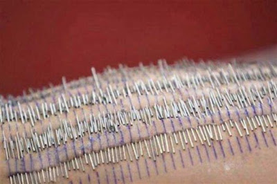 Amazing World Record 3200 Needles In The Body