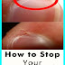 How to Stop Your Cuticles From Cracking and Peeling After a Manicure!