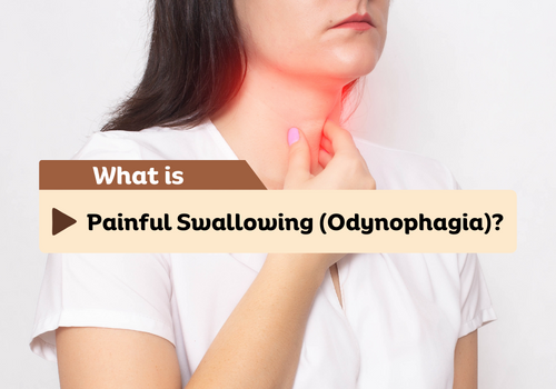 What is Odynophagia?