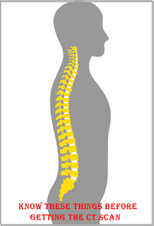 सी. टी स्केन करवाने से पहले जान ले यह बातें 