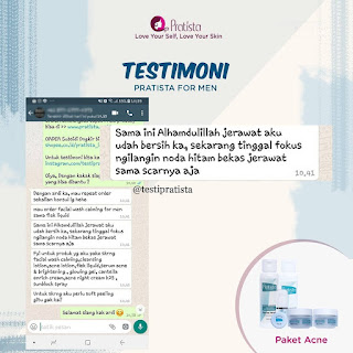  Testimoni For Men Menghilangkan Jerawat Dan Bekasnya Sampai Ngacir Dengan Mulus (200)