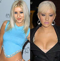 Celebrities Before And After Plastic Surgery