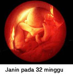 foto janin minggu ke 32