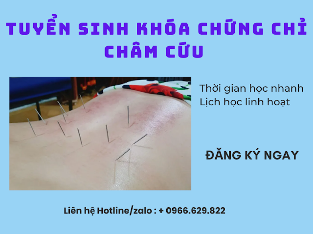 Thông báo nhận hồ sơ khóa ngắn hạn châm cứu tại Huyện Long Thành