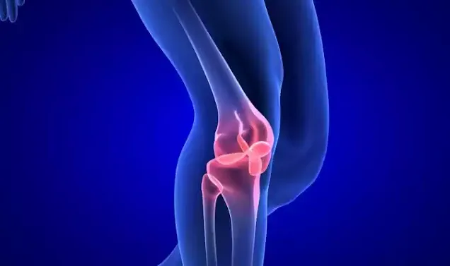 Arthritis Pain