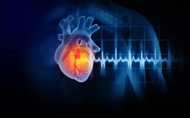Heart Attack (Acute Myocardial Infarction)- Medical & Health 
