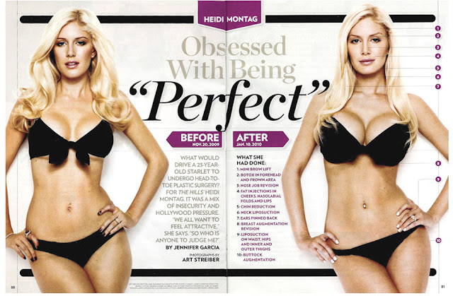 Heidi Montag Plastic Surgery