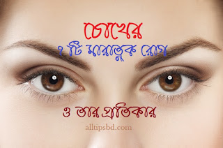 চোখের সাতটি মারাত্নক রোগ ও তার প্রতিকার