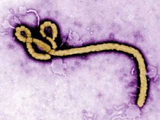 Vírus ebola