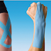 Kinesio Tape, The Magic Plaster For Athletes