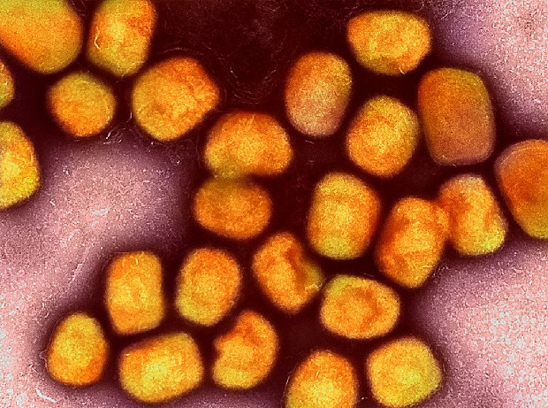 Monkeypox virus