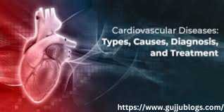 what are the types of cardiovascular?