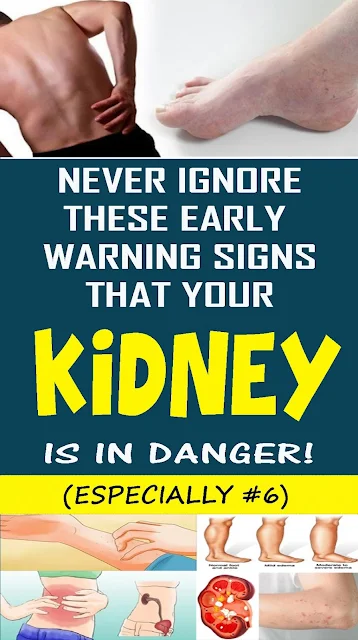 On the off chance that Your Kidney Is in Danger, the Body Will Give You These 7 Signs!