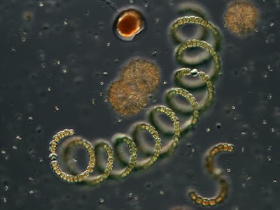 Anabaena sp