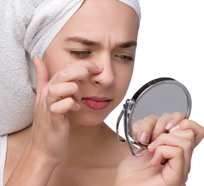 quickly Remove Blackheads 