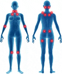 fibromiyalji hassas bölgeler