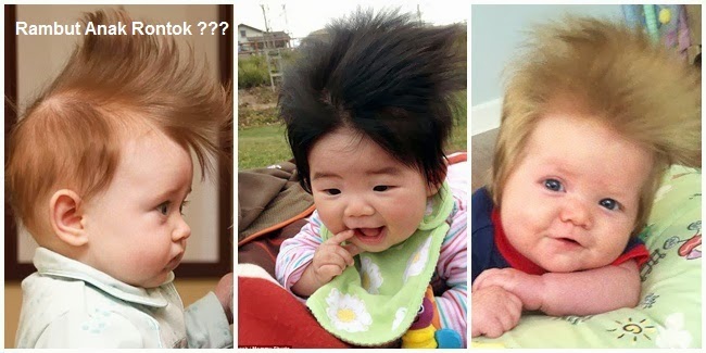 Kenapa Rambut  Anak  Rontok  Ini Cara Merawat Rambut  Anak  