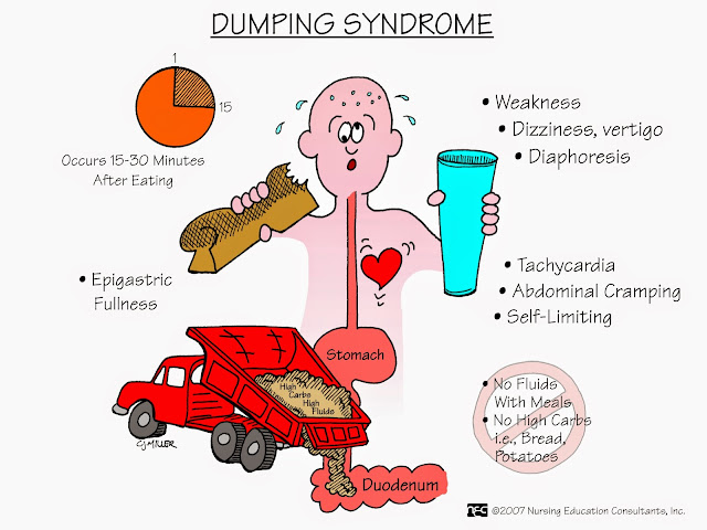 Dumping Syndrome - Gastroparesis