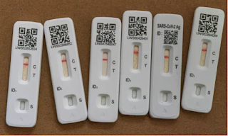 A man in Britain has tested positive for corona for more than 500 days  What is the explanation for the fact that the results of the Corona test for a British man remained positive for more than 500 days? What is the relationship of weak immunity to corona mutations? And where did the efforts to vaccinate the entire population of the world against Corona reach?  What is the explanation for the fact that the results of the Corona test for a British man remained positive for more than 500 days?  A record number of people infected with Covid-19 virus in the United Kingdom, where since he was first confirmed to be infected in the middle of 2020, the British patient remained in this condition for 16 months until his death.  There are still many uncertain answers about loss of sense of smell and taste due to infection with the Corona virus, so what do studies say so far about loss of sense of smell?  And when will people infected with the virus regain their ability to distinguish smells, as they were before infection with the virus?  Source: Al Jazeera this morning FacebookThere are still many uncertain answers about loss of sense of smell and taste due to infection with the Corona virus, so what do studies say so far about loss of sense of smell?  And when will people infected with the virus regain their ability to distinguish smells, as they were before infection with the virus?  Source: Al Jazeera this morning Facebook  And the newspaper " Leparisien " published a report on the longest known case of the Covid-19 virus, according to a study on the development of the virus in patients with immunodeficiency, where the patient - whose identity was not revealed - was suffering from respiratory problems, Study co-author Dr Jaya Nyebia said he remained positive on all tests, around 45, until his death 505 days later.  This is the longest known case of COVID-19 infection, the paper explains. The study was presented at the European Conference on Microbiology and Infectious Diseases, which was held in Lisbon from 23 to 26 April.  9 patients The study was led by researchers from "King's College London" and Guy's Hospital and St Thomas' in London, and looked between March 2020 and December 2021 in the case of 9 patients with immunodeficiency and chronic infection with the virus.  All tests were positive for at least 8 weeks, two of them were positive for more than a year, and among the nine patients, 4 died and 4 eventually recovered, and the last patient was still infected at the beginning of 2022, 412 days after he was first tested.  "Immunocompromised patients with chronic infection have little chance of survival, and new treatment strategies are urgently needed to end the infection," said Dr. Gaia Nebea.  For his part, Dr Luke Blagdon-Snell, an infectious disease expert at the British National Health Service (NHS) who participated in the study, said that it "certainly appears to be the longest infection reported," according to a report by "Time ".  There are still many uncertain answers about loss of sense of smell and taste due to infection with the Corona virus, so what do studies say so far about loss of sense of smell?  And when will people infected with the virus regain their ability to distinguish smells, as they were before infection with the virus?  Source: Al Jazeera this morning FacebookThere are still many uncertain answers about loss of sense of smell and taste due to infection with the Corona virus, so what do studies say so far about loss of sense of smell?  And when will people infected with the virus regain their ability to distinguish smells, as they were before infection with the virus?  Source: Al Jazeera this morning Facebook  Corona mutations The study investigated the mutations that develop in people with very long infections, and whether variants evolve.  " In long-term Covid , it is generally assumed that the virus has been removed from your body but the symptoms persist," Snell said. "But with persistent infection, this represents an active and continuing replication of the virus."  Each time the researchers tested patients, they analyzed the virus' genetic code to ensure it was the same strain and that they had not contracted COVID-19 more than once. However, genetic sequencing showed that the virus changed over time, mutating as it adapted.  Snell said the mutations were similar to those later seen in widespread variants, although none of the patients generated new mutations that became worrisome variants. There is also no evidence that they spread the virus to others.  Japan's Shinoji Trial Anti-Corona Tablets Quickly Kill the Virus Japan's Shionogi Pharmaceutical Company said on Sunday that new data showed that an experimental treatment for Covid-19 of its production quickly eliminated the virus that causes the disease in an advanced stage of clinical trials.  The company hopes that the experimental treatment - which is tablets - will achieve global spread after obtaining the approval of the regulatory authorities in Japan, which are currently examining it.  The company added that the results, issued the day before yesterday, Sunday, showed that the drug improved respiratory symptoms and fever caused by the disease.  The company indicated last March that it would launch the third phase of clinical trials for the treatment globally, with the support of the US government.  There are still many uncertain answers about loss of sense of smell and taste due to infection with the Corona virus, so what do studies say so far about loss of sense of smell?  And when will people infected with the virus regain their ability to distinguish smells, as they were before infection with the virus?  Source: Al Jazeera this morning Facebook  The campaign to vaccinate the entire world's population against COVID-19 is losing steam Vaccination rates in most low-income countries are slowing to fall behind the World Health Organization's goal of fully immunizing 70% of the population in every country by June 2022.  In a report published by the American newspaper " The New York Times", writers Rebecca Robbins and Stephanie Nolin said that there is a growing feeling among public health experts that high vaccination coverage against the Covid-19 virus may never be achieved in most low-income countries. With critical US funding drying up, other governments and donors are turning to other priorities.  Only a few of the world's 82 poorest countries - including Bangladesh, Bhutan, Cambodia and Nepal - were able to get the chance to vaccinate 70 percent of the population, but many did not exceed 20 percent, according to data collected from government sources by the project. Our World in Data" at the University of Oxford. In contrast, about two-thirds of the world's richest countries have achieved a vaccination rate of 70%, including the United States (66%).  Consequences of not achieving high vaccination coverage The authors point out that the consequences of abandoning high vaccination coverage worldwide could be dire. Public health experts say that abandoning global efforts to immunize may lead to the emergence of new and dangerous mutations that would threaten the world's efforts to coexist with the virus.  Countries in different parts of the world, including some Eastern Europe and the Middle East, have seen stagnant vaccination rates in recent months, but Africa's vaccination rate remains the worst. Less than 17% of Africans have received a primary vaccination against the Covid-19 virus, while half of the vaccine doses delivered to the continent have not yet been used. Last March, the number of doses given on the continent decreased by 35% compared to last February, and WHO officials attributed this decrease to the dispensation of mass vaccination campaigns with smaller campaigns in many countries.  Some global health experts say the world missed a good opportunity last year to deliver vaccines to low-income countries when the population was most afraid of Covid-19 and ready to get vaccinated. What remained of the momentum in the global vaccination campaign has now been hampered by a lack of funding for equipment, transportation and medical staff.  Reasons for optimism On the other hand, some public health experts point out that there are reasons for optimism that the global vaccination campaign is still in place. Earlier this April, the Gavi Vaccine Alliance attracted an important new batch of funding pledges, securing $4.8 billion in commitments, but it fell short of its $5.2 billion goal. There is also hope that the global COVID-19 summit that the White House plans to co-host next month will be an opportunity to generate momentum and funding.  The two writers mentioned that the decline in public demand has led some health officials and experts to question whether the 70% vaccination goal is feasible or even reasonable.  The number of reported deaths from COVID-19 remains relatively low in sub-Saharan Africa, although there is controversy over poor tracking of the data. However, the perception in many countries of the region is that the disease does not pose a serious threat, certainly not as much as other prevalent health problems that require more focus on scarce healthcare resources.  Viva Rahman - civil society representative in a group launched by the World Health Organization to coordinate the global response to the Covid-19 virus - said that many low-income governments are shifting their focus to their economies and other health issues, noting that "there is a sense that there are many competing priorities now, but This is a symptom of fading momentum, because when the momentum was there, everyone was looking for vaccines."  Measles For example, rural areas of the Democratic Republic of the Congo, where the reported COVID-19 death rate is very low, are seeing an increase in measles cases, threatening 20 million children.  According to Christopher Mambula, MSF's medical director for East Africa, the government says it does not have enough resources to provide complementary measles vaccinations this year. In this context, it makes no sense to continue diverting resources to mass vaccination against COVID-19. As African governments receive more vaccines from rich countries and face difficulties in distributing them, their interest in ordering more doses has declined.  While it appears that the 70% vaccination threshold cannot be achieved by the deadline, some public health experts argue that it would be unwise and unethical to abandon this target over a longer period of time.  They have expressed frustration at the growing chasm between wealthy nations that vaccinate young children and deliver the fourth dose to healthy adults, while the majority of the population in some areas has yet to receive a single dose.  Source : Al Jazeera + Agencies + Time + Le Parisien