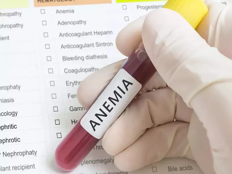 Os 10 Melhores Remédios Caseiros Para Anemia