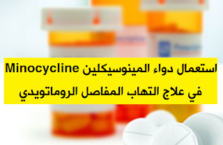استعمال دواء المينوسيكلين Minocycline في علاج التهاب المفاصل الروماتويدي
