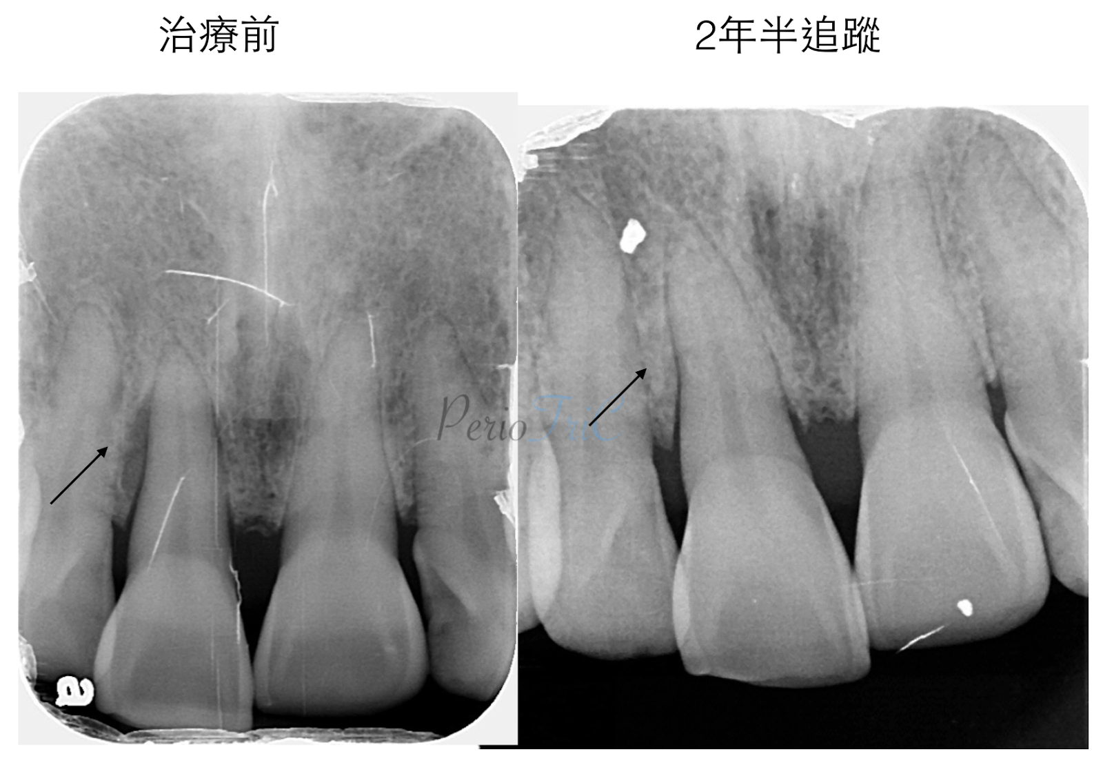 張志嘉 霹靂牙醫periotric 15