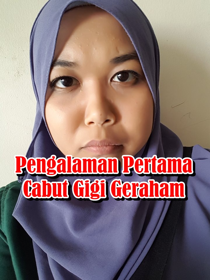 Pengalaman Pertama Cabut Gigi Geraham | Eintan Nurfuzie ...