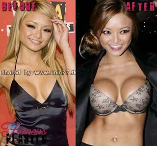 enlarged_celebs_breasts_640_04.jpg (640×595)