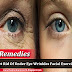 Get Rid Of Under Eye Wrinkles Facial Exercise