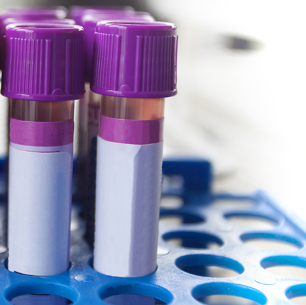 Cosyntropin Test Interpretation, Procedure, Timing, Dose, Positive