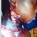 Wickedness: Man pours hot water on 13-year-old housemaid (GRAPHIC IMAGE)