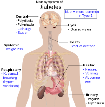 Diabetes symptoms