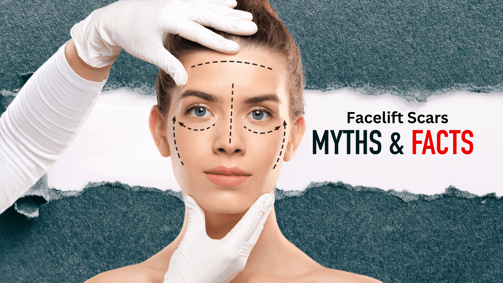 combating-common-myths-about-face-lift-scars-barbies-beauty-bits