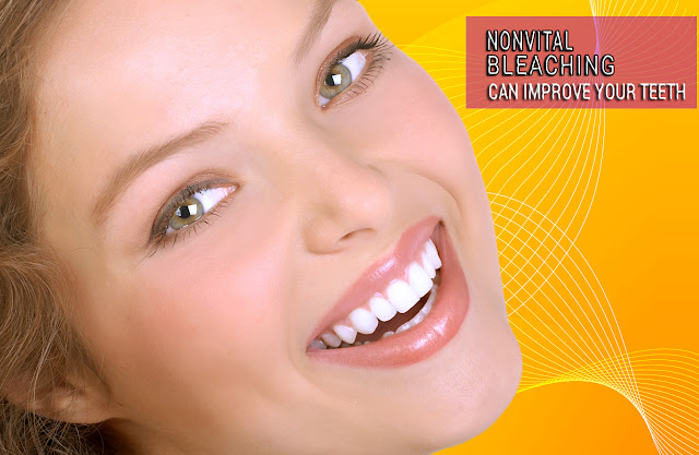 Non Vital Bleaching Helps to Improve Your Teeth