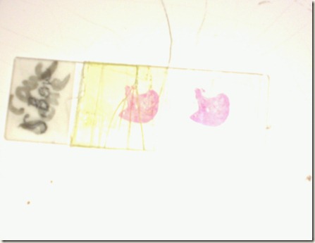 Spongy bone staining on glass sldie
