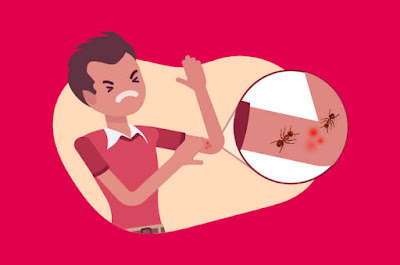 Cara Mengatasi Semut Pada Rumah atau Gedung Walet