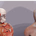Facial Transplant Video