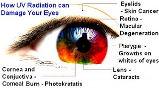 ultra violet rays damage on eye disease picture