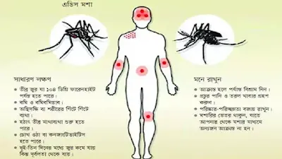 ডেঙ্গু জ্বরের লক্ষণসমূহ