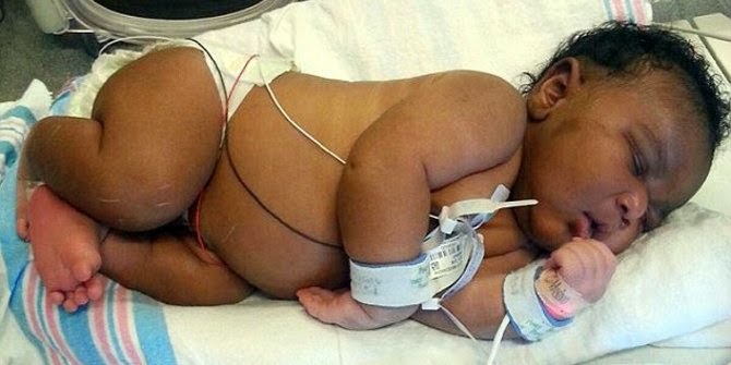 Tidak Tahu Sedang Mengandung, Ibu di AS Melahirkan Bayi Seberat 6 Kg