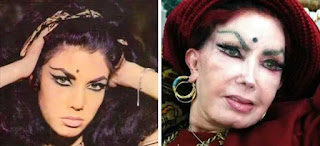 11 Celebrities Whose Plastic Surgeries Turned Out Worse Than Everyone Else