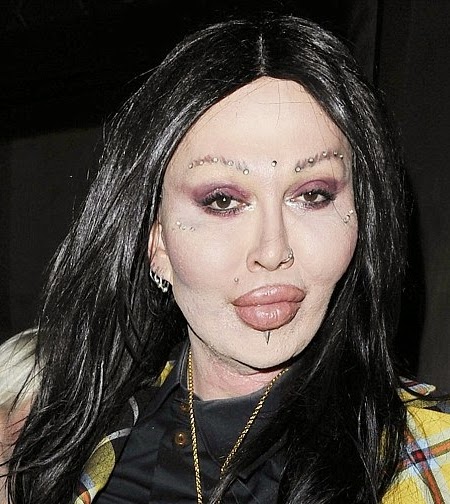 Pete Burns Biography - Peter Jozzeppi Burns Died