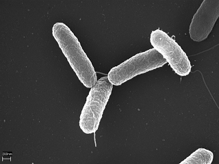 Apa itu Virus Salmonella?